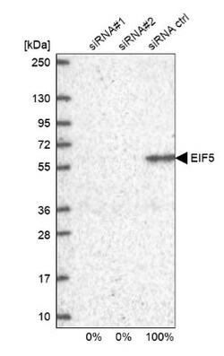 EIF5 Antibody, Novus Biologicals 25 &mu;L; Unlabeled:Antibodies, Polyclonal